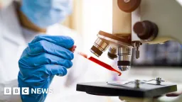 Brazil Monitors Two Patients for Potential Ebola Cases