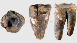 Neanderthals Practiced Dentistry 60,000 Years Ago in Siberia