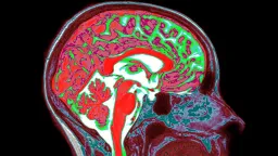 Estrogen in Both Sexes' Brains Shapes Trauma Response, Study Suggests