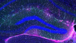 Exercise's Alzheimer's Defense: Scientists Uncover Key Brain Barrier Mechanism