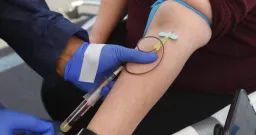 Alberta Proposes Bill to Expand Private Medical Testing Access