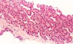 AKAP1: A Revolutionary Target in Liver Cancer Metabolism
