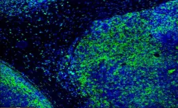 Atezolizumab-Bevacizumab Shows Efficacy in Select Child-Pugh B Liver Cancer Patients