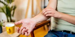 The Biological Paradox of Scratching an Itch