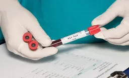 HIV Crisis Deepens in Middle East and North Africa