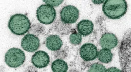 Third Death Linked to Hantavirus Outbreak on Dutch Ship