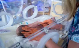 Stenting Achieves Lumen Restoration in Neonatal Aortic Coarctation Study
