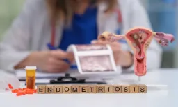 Cryoablation Shows Promise for Umbilical Endometriosis Pain