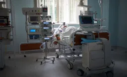 Sepsis Survival Paradox: Severity Alters AKI Patient Outcomes