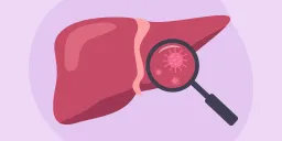 The Silent Threat: Understanding Liver Disease in Women