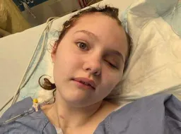 Maya Gebala's Skull Repair Surgery Successful, Father Reports