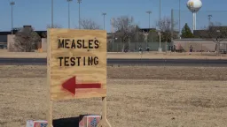 Measles Resurgence Signals Broader Public Health Weakness