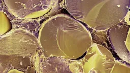 Scientists Identify Crucial Protein Switch for Human Fat Metabolism