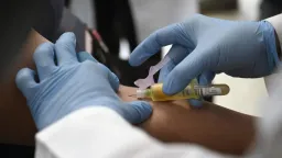 Singapore Boosts MediSave for HIV Drugs, Aims to Curb Stigma and Late Diagnosis