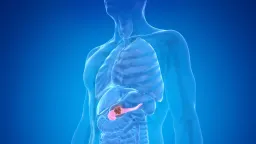 AI Model Spots Pancreatic Cancer 3 Years Earlier Than Doctors