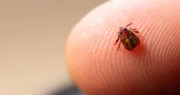 New Brunswick Launches Tick Tracker Amid Surge in Lyme Disease Cases