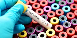 NYC Legionnaires' Outbreak Kills 4th, 76 Cases Linked to Cooling Towers