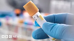 Italian Parents Accused of Hiding Daughter's HIV, Denying Medical Care