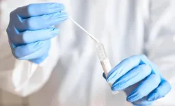 Portable TB Swab Test Meets WHO Accuracy Targets in Global Study