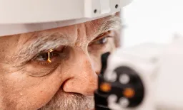 Retinal Artery Occlusion Signals Major Cardiovascular Risk