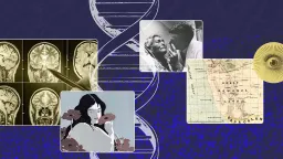 Rare Genetic Mutation Challenges Understanding of the Brain's 'Fear Center'