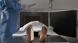 Rigor Mortis: Understanding the Science of Post-Death Stiffening
