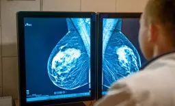 MRI-Guided Sonography Boosts Breast Lesion Detection by 91%