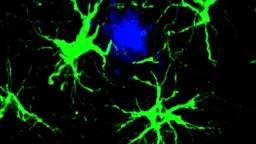 Engineered Brain Cells Slash Alzheimer's Plaques by 50% in Mice