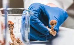 Single Psilocybin Dose Reshapes Brain Function and Anatomy