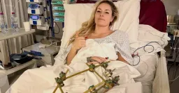 Lindsey Vonn: Surgery Saved Olympic Leg from Amputation