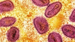 Singapore Reports First Local Mpox Cases Amid Clade Ib Outbreak