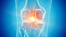 Semaglutide Shows Promise in Reversing Osteoarthritis Damage