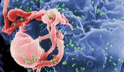 Toronto Patient Achieves HIV Remission Following Cancer Treatment