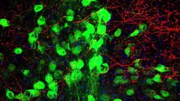 New Brain Link Found Between Tourette Syndrome and OCD
