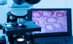 Moroccan Study Shows Safer Prostate Biopsy Technique