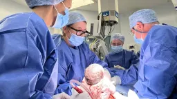 UK's First Deceased Donor Womb Transplant Birth Heralds New Era for Motherhood