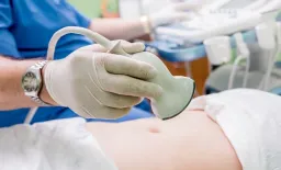 New Study Reveals Key Ultrasound Differences in Uterine Fibroid Variants
