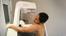 WHO: Cancer Cases Could Nearly Double by 2050 Without Urgent Action