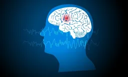 Zorevunersen Shows Promise in Treating Dravet Syndrome Seizures