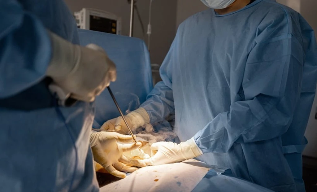 Surgical Smoke in Robotic Bladder Cancer Surgery Shows No Cancer Spread Risk