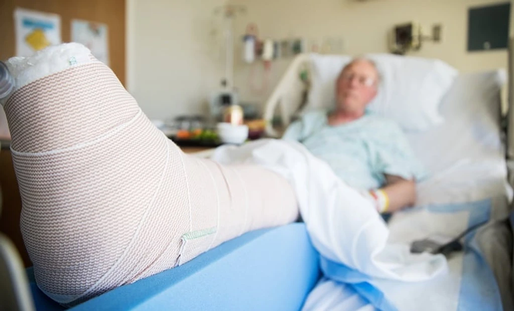Type 2 Diabetes Linked to Higher Fracture Risk, Major Study Finds
