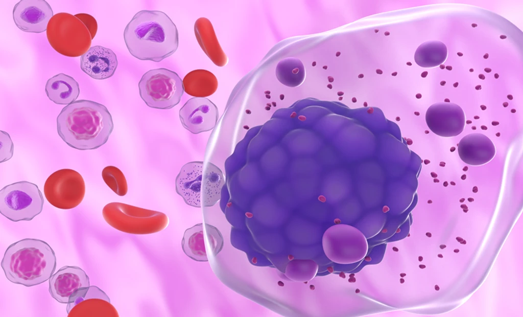 Talquetamab Combinations Set New Standard in Relapsed Myeloma Care