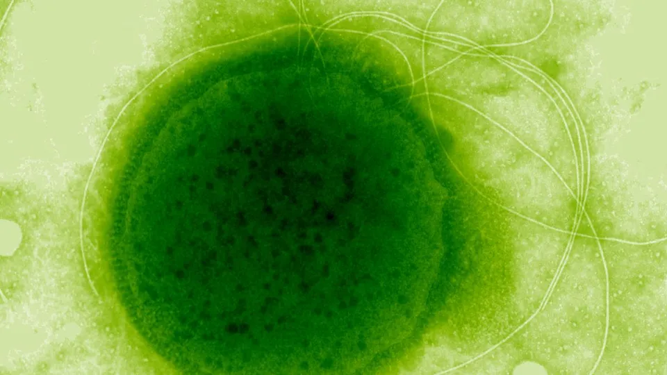 Deep-Sea Microbe Boasts Unexplained Radiation Resistance