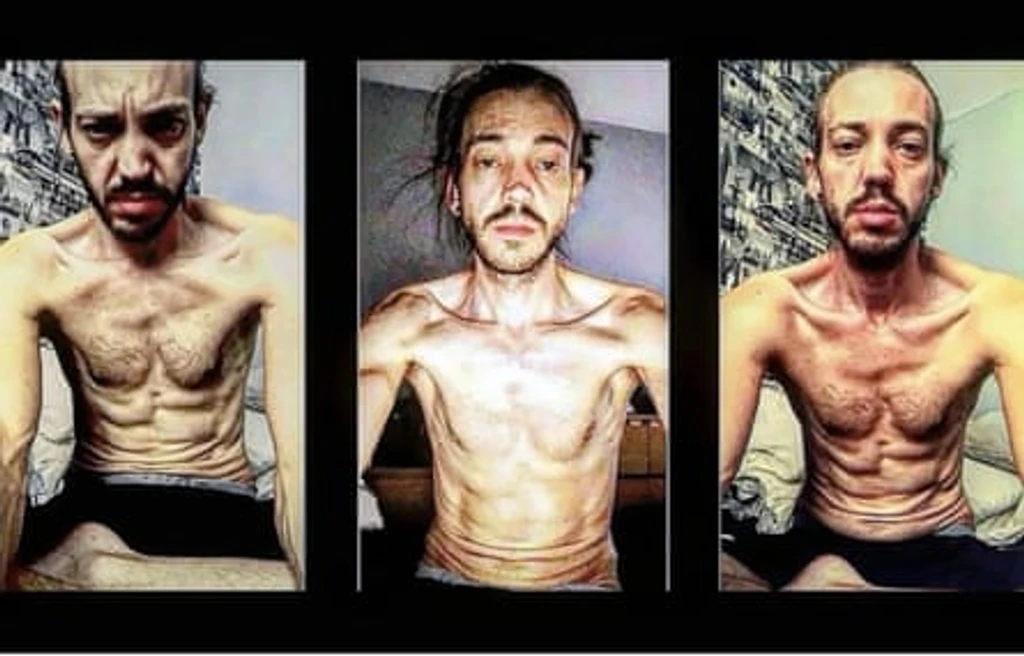 - Figure 1 - 