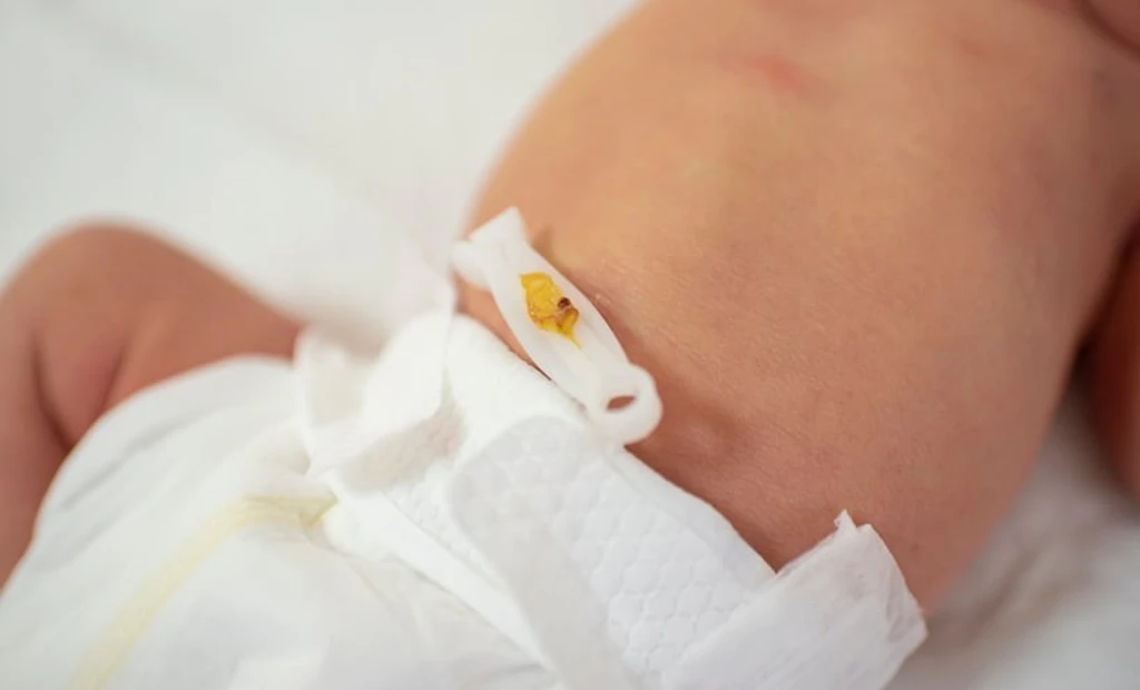 Chlorhexidine Antiseptic Reduces Newborn Deaths in Developing Countries