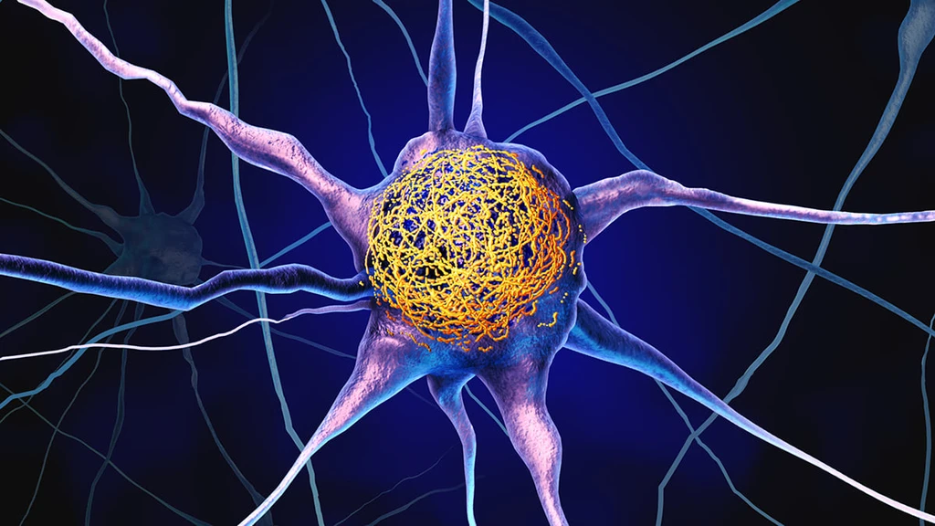 Vitamin D Linked to Reduced Alzheimer's Protein Buildup