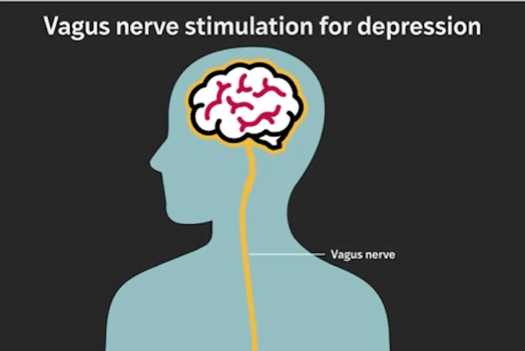 - Figure 1 -