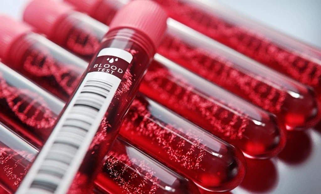 Wilson Disease Genetics: Advanced Testing Resolves Diagnostic Gaps