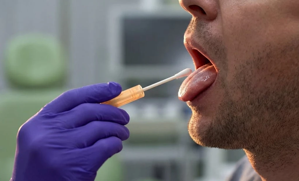 WHO Backs Faster, Cheaper TB Tests Including Tongue Swabs