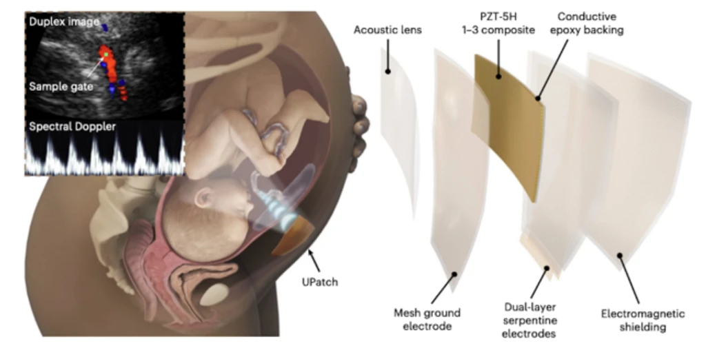 - Figure 1 - 